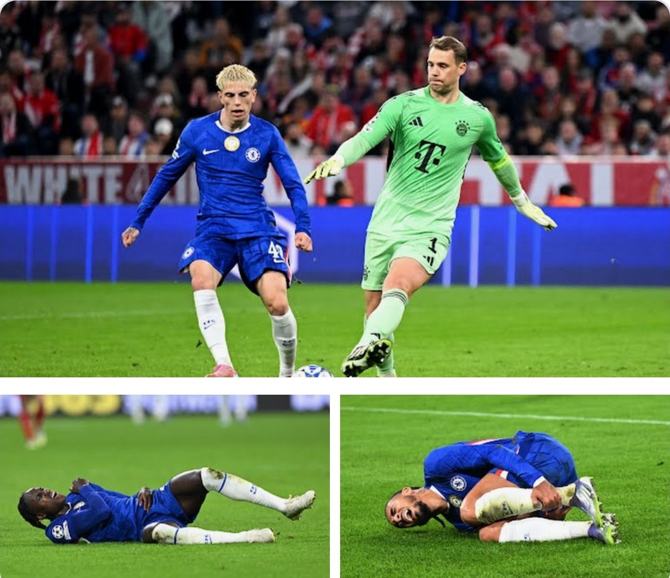 Chelsea preget av skadeproblemer – etter Bayern-tap: Kan mangle 11 spillere mot United